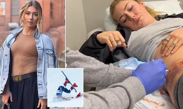 Mikaela Shiffrin Crash Brings Alpine Skiing Safety Awareness To The Fore